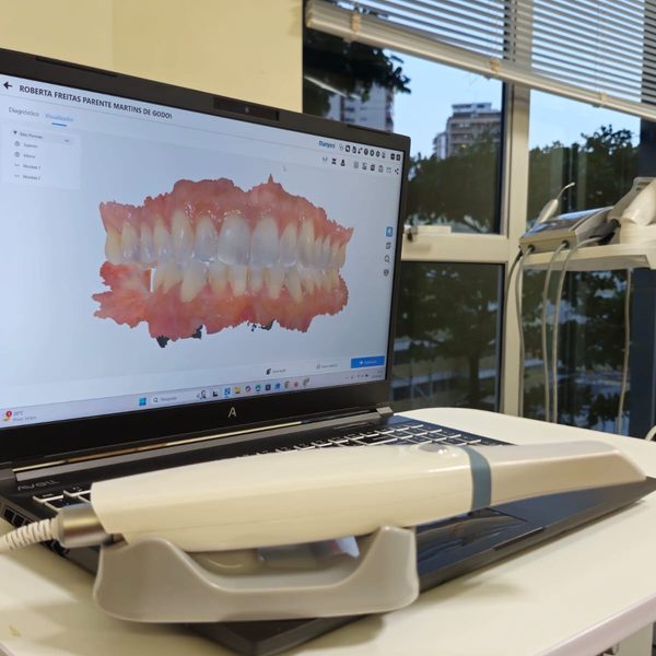 Scanner intraoral da clínica com a arcada dentária no monitor